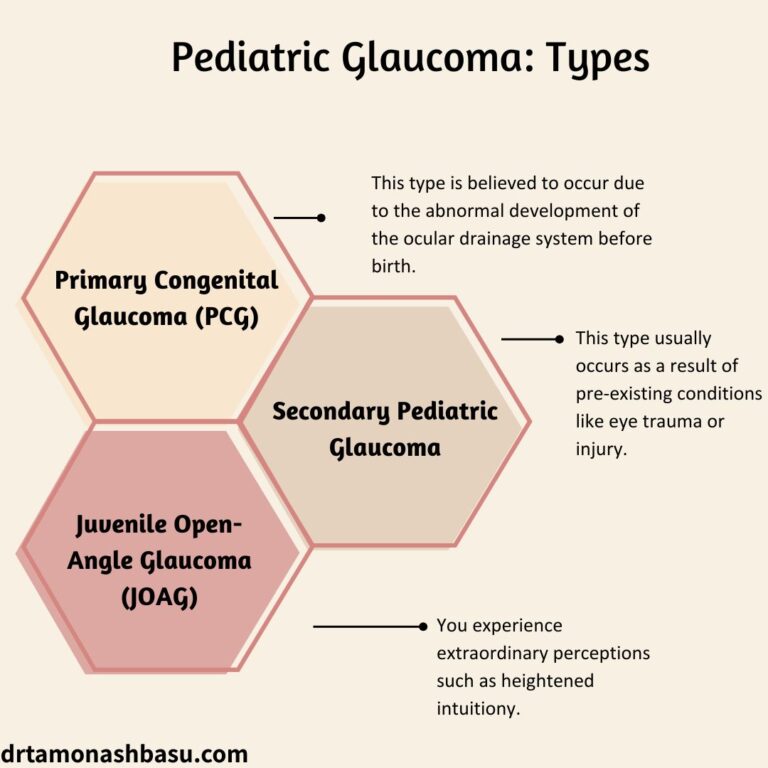 Types Of Pediatric Glaucoma